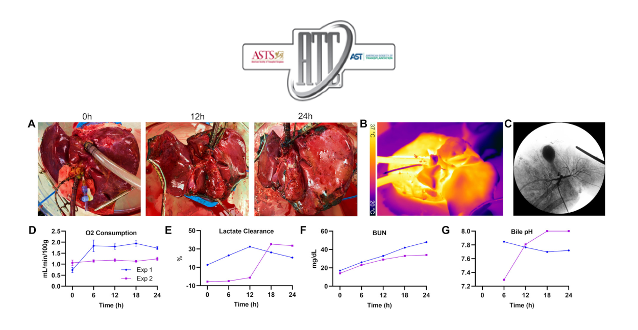 Xenogeneic Cross-Circulation Supports Ex Vivo Human Livers for 24 Hours