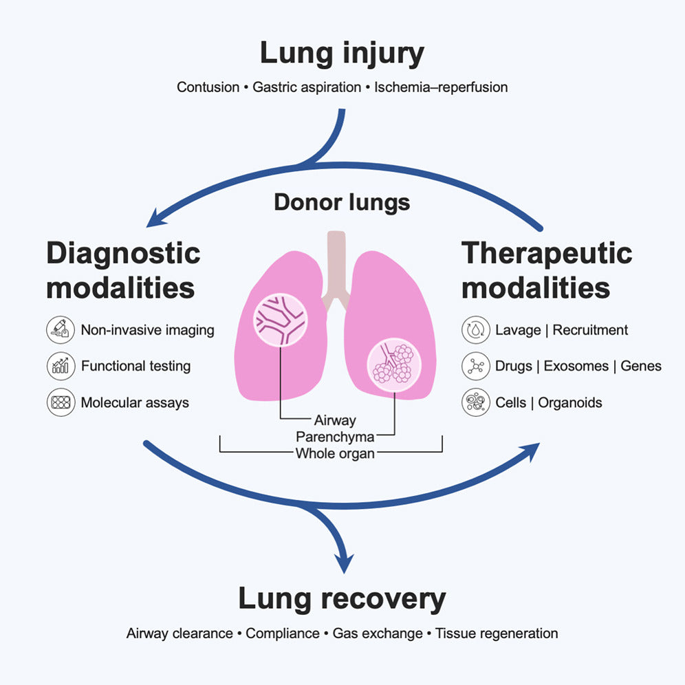 Theranostic Methodology for Ex Vivo Donor Lung Rehabilitation