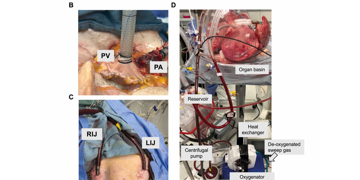 Lung Rehabilitation Using Xenogeneic Cross-Circulation Does Not Lead to Hyperacute Rejection in a Human Lung Transplantation Model