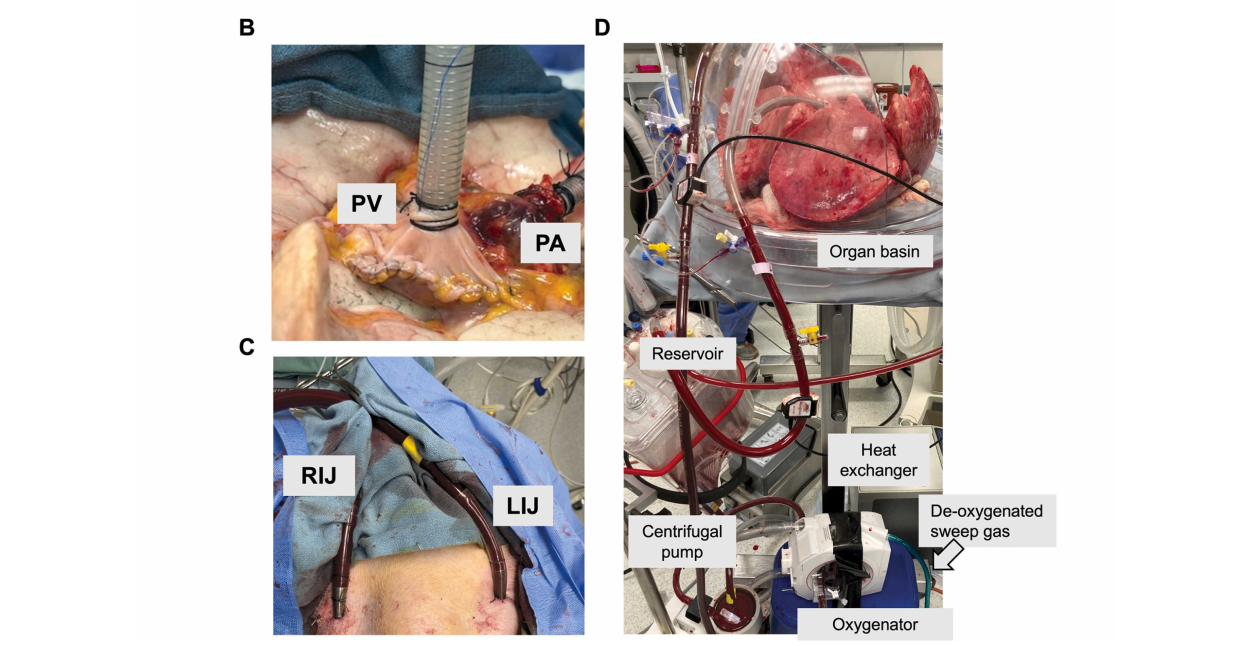 Lung Rehabilitation Using Xenogeneic Cross-Circulation Does Not Lead to Hyperacute Rejection in a Human Lung Transplantation Model