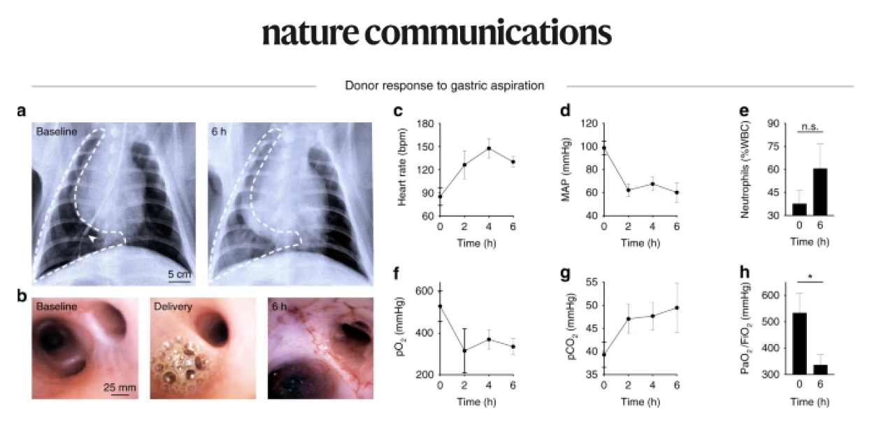 Regeneration of Severely Damaged Lungs Using an Interventional Cross-Circulation Platform