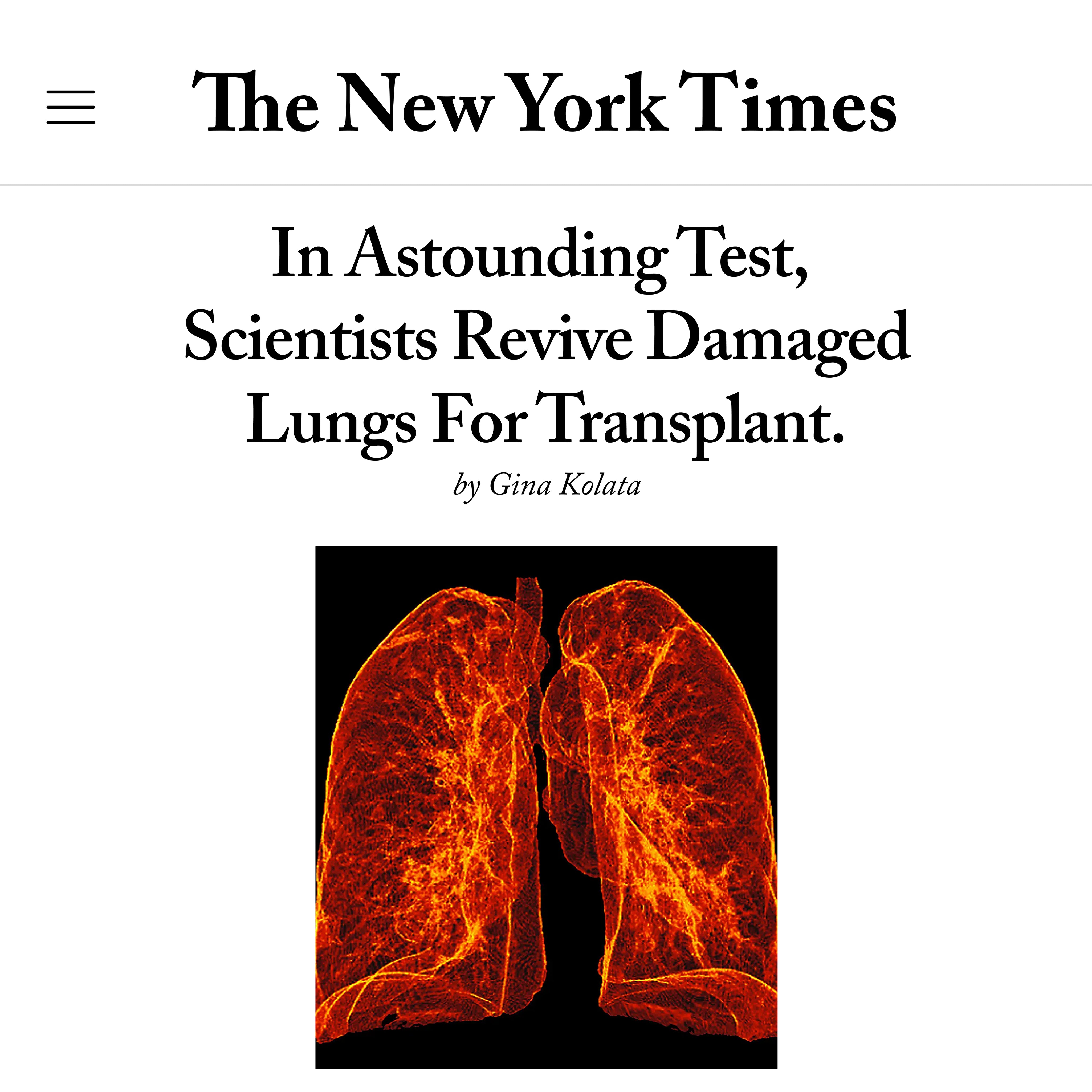 NYTimes-1x1.jpg