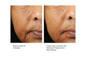 Elasticity Reinforcing Hydra-Cream