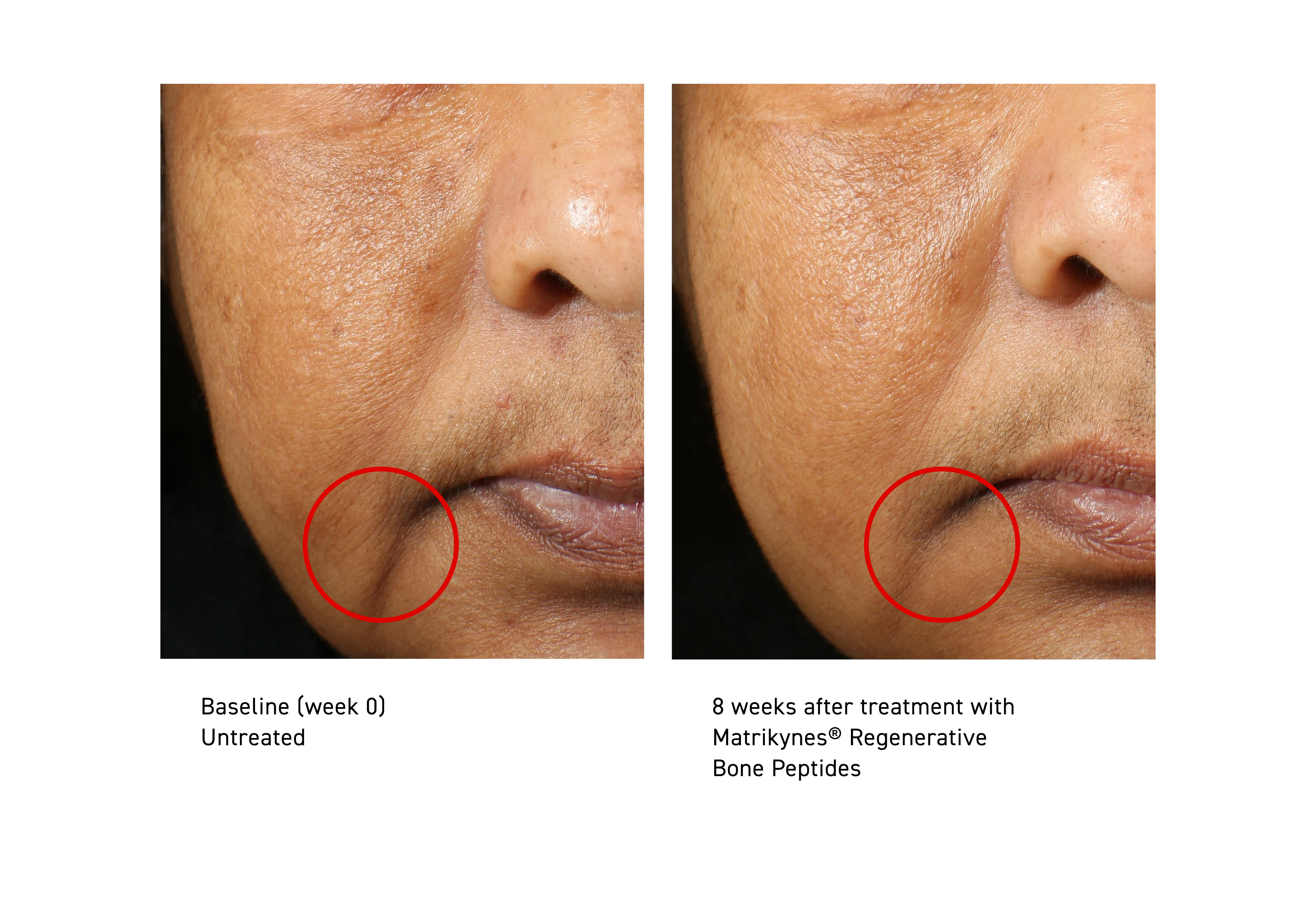 Elasticity Reinforcing Hydra-Cream