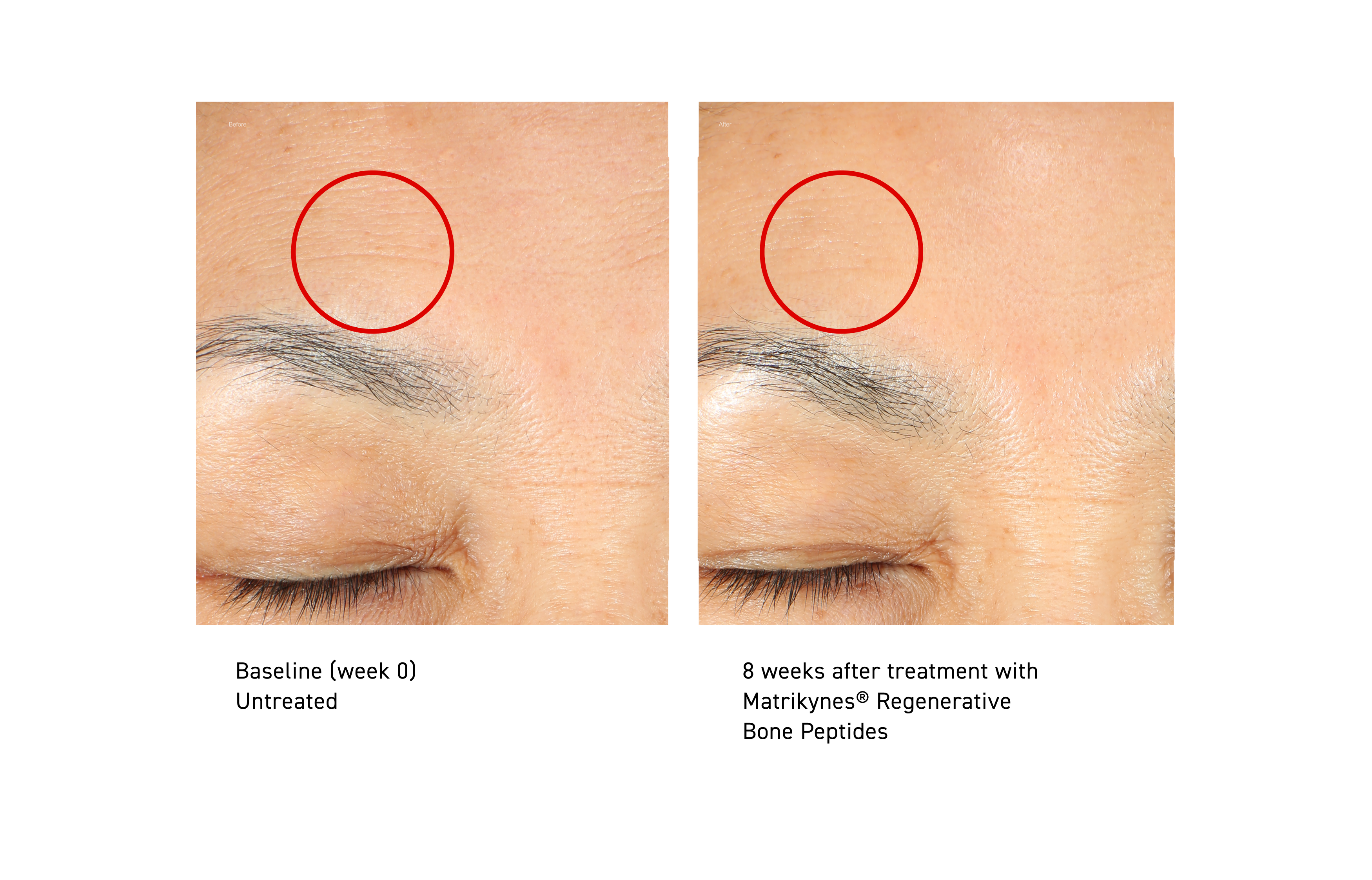 Barrier Repairing Hydra-Serum