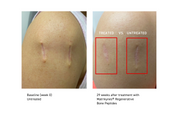 Barrier Repairing Hydra-Serum