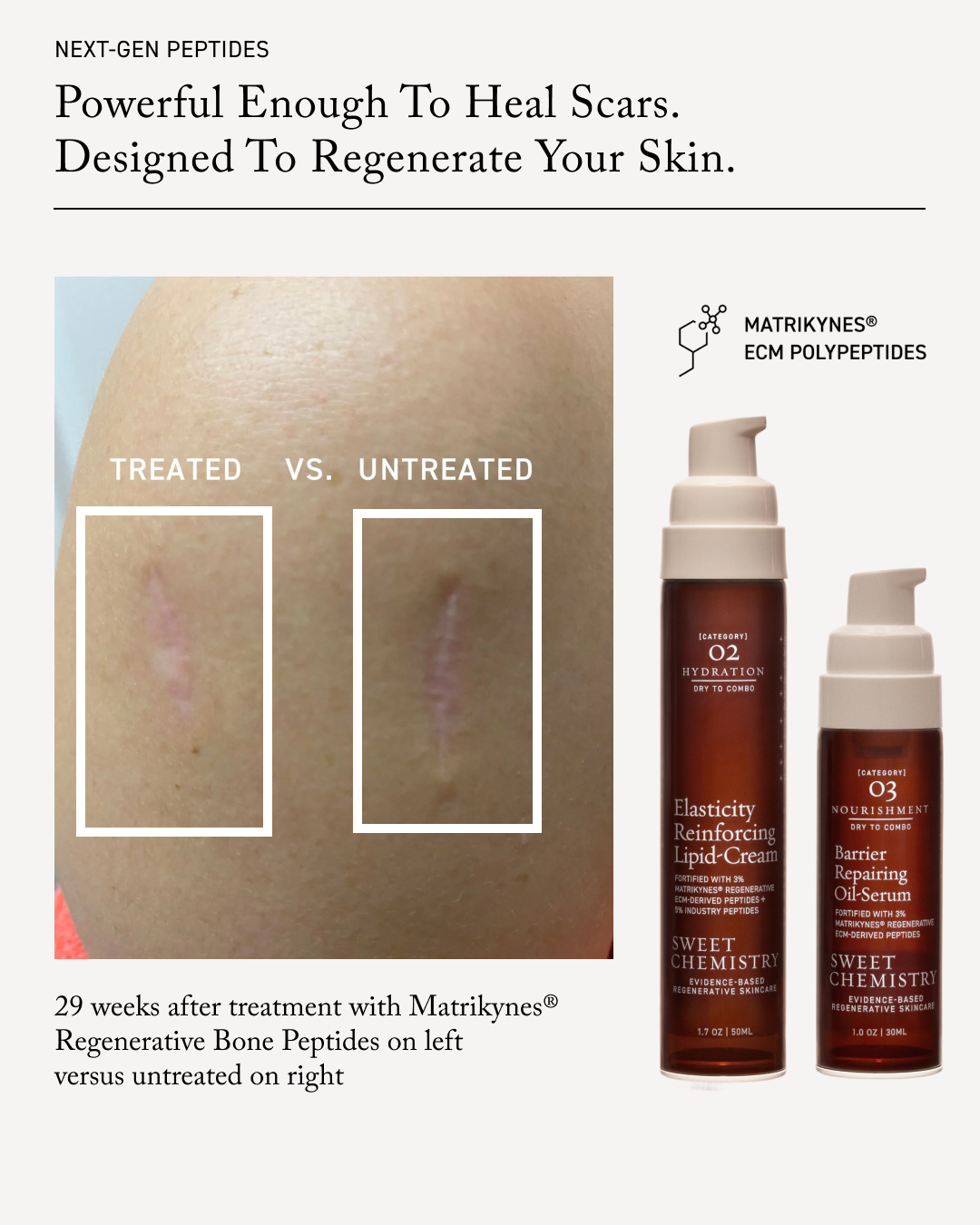 The Lipid-Cream + Oil-Serum Duo