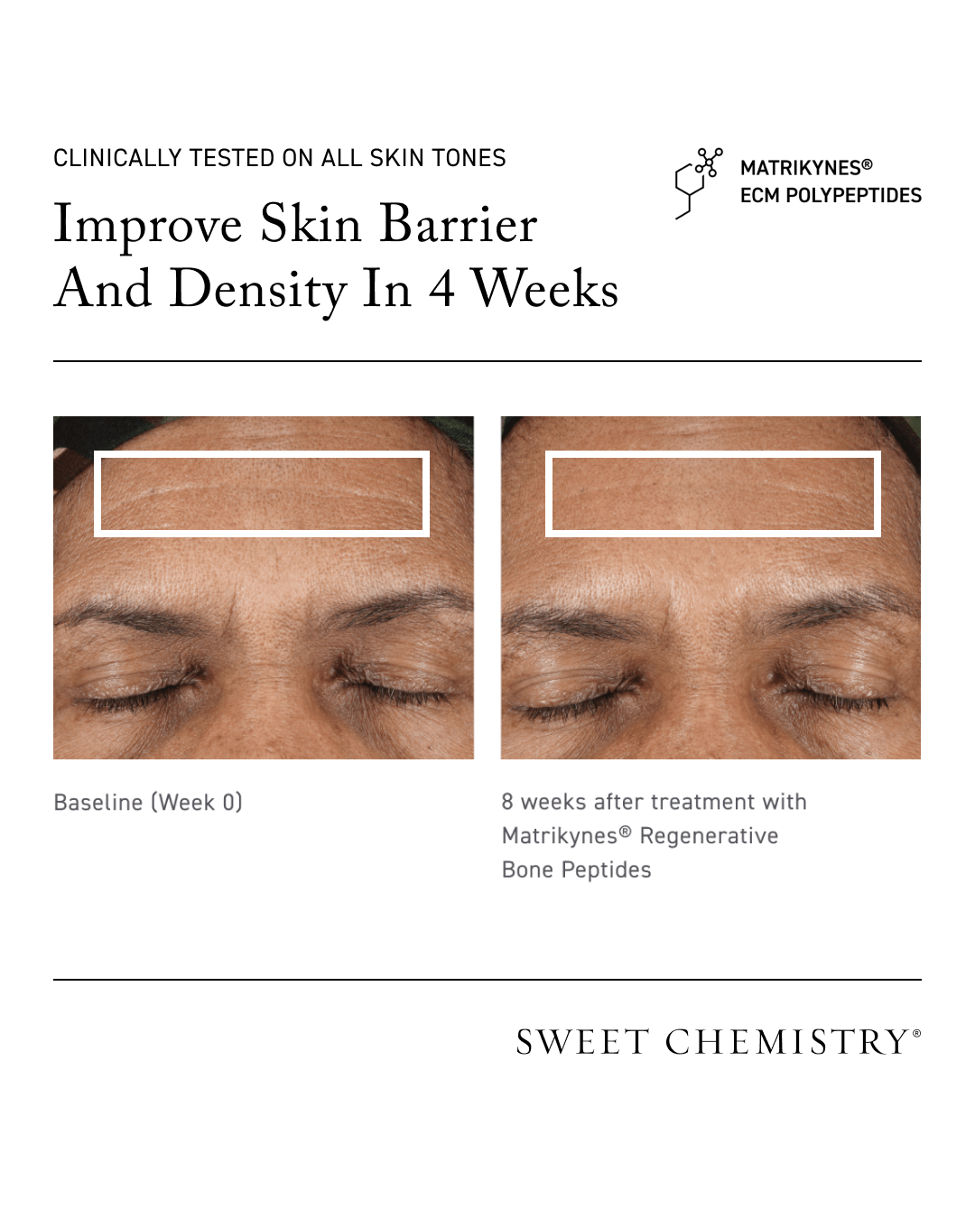 Elasticity Reinforcing Hydra-Cream