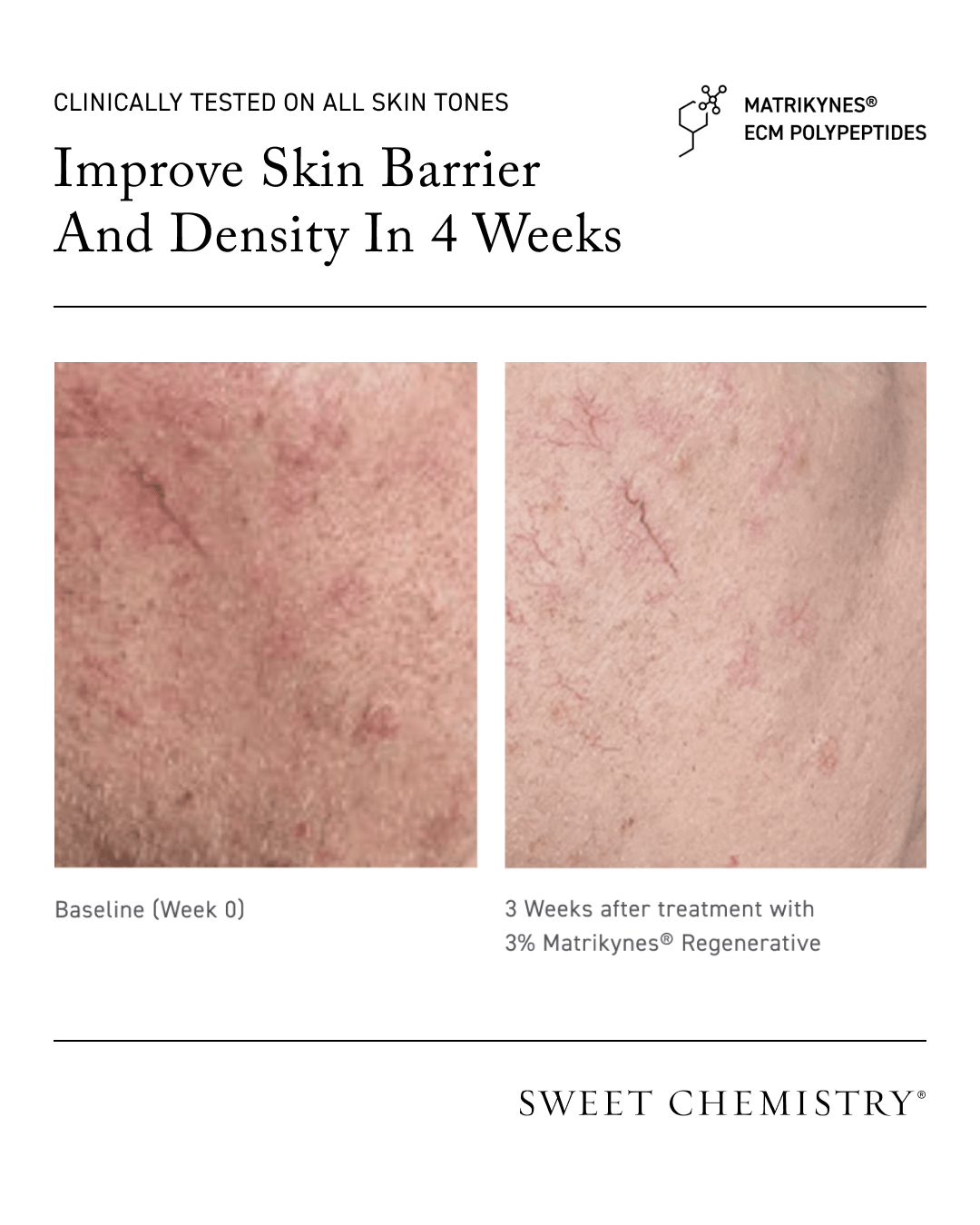 Barrier Repairing Hydra-Serum