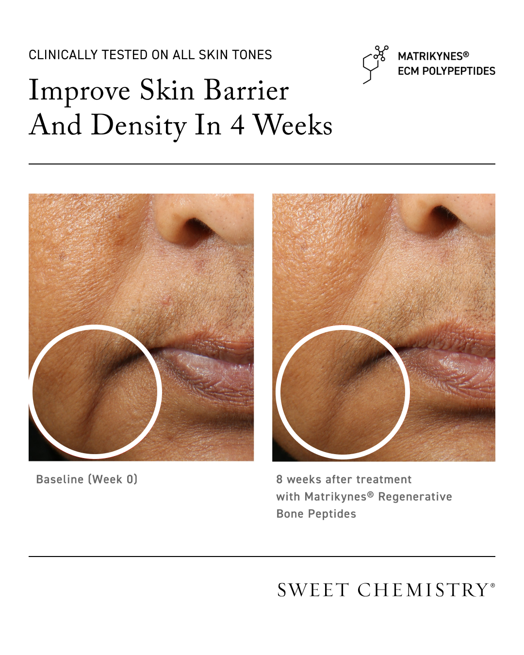 Elasticity Reinforcing Lipid-Cream