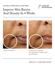 Elasticity Reinforcing Lipid-Cream