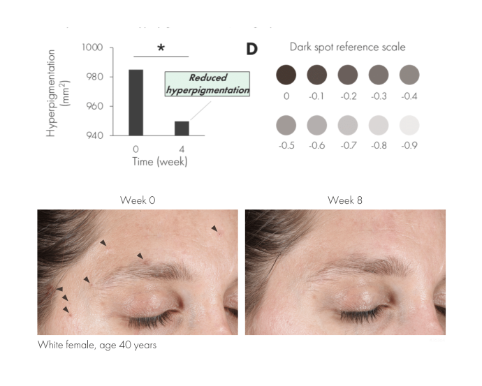 Improve the appearance of hyperpigmentation &amp; age spots