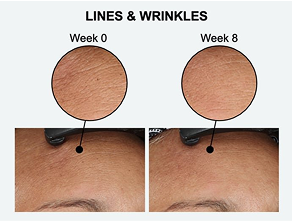 Visibly reduces global fine lines &amp; wrinkles