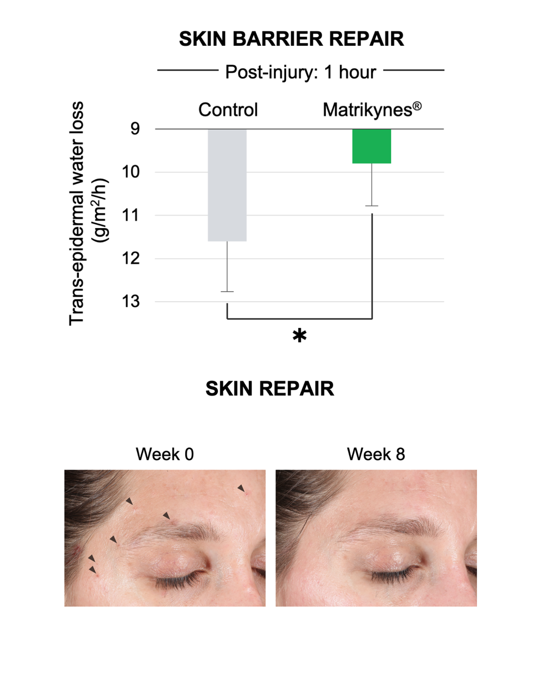 Barrier Repairing Hydra-Serum