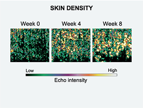 Increase skin density (collagen)