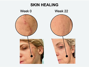 Improve skin barrier repair within 1 hour